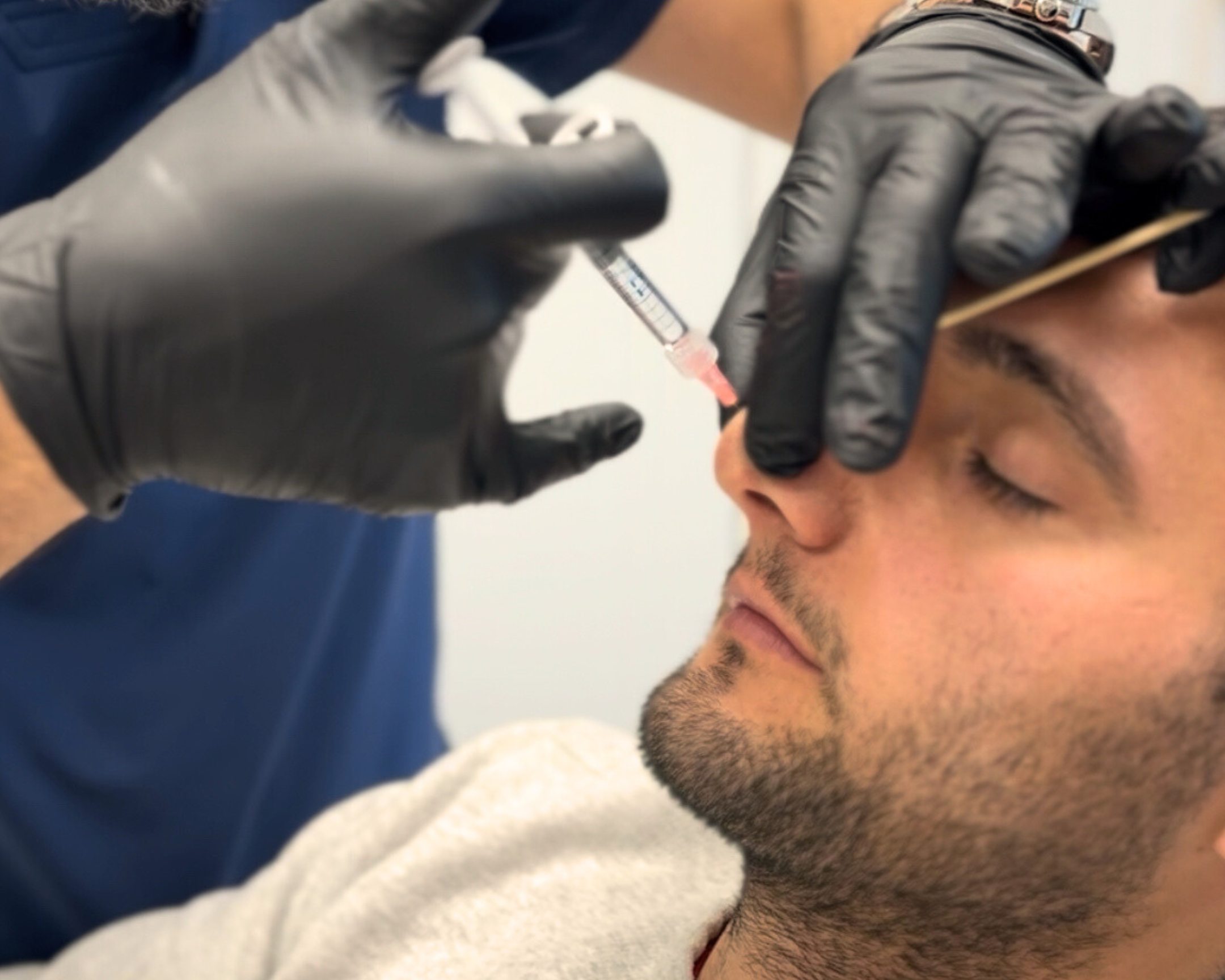 Non-surgical Rhinoplasty Master Course 