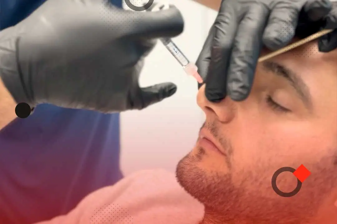 Non-surgical Rhinoplasty Master Course 